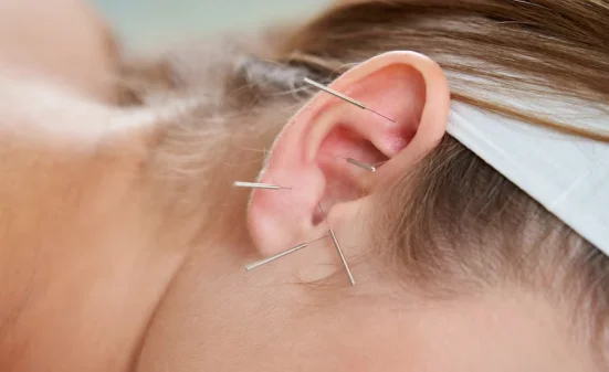 Auricular Acupuncture in NY