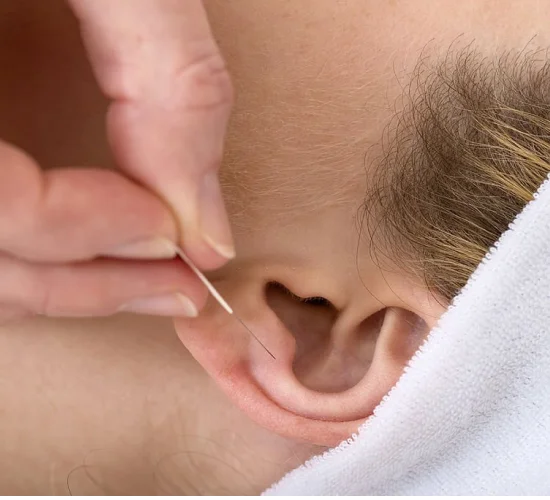 auricular acupuncture therapy