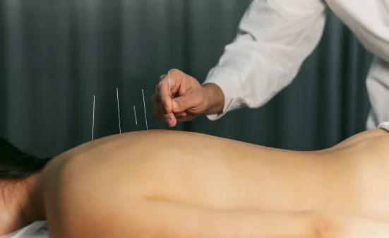 The benefits of Neuro-Acupuncture