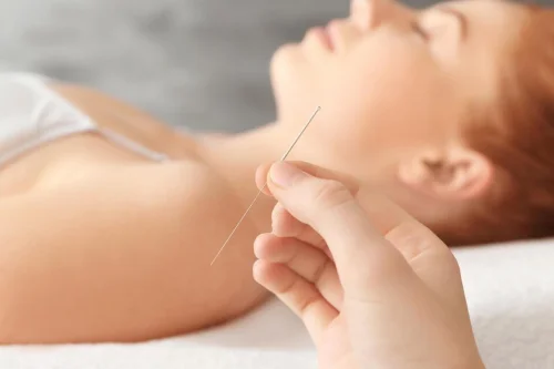 what is cosmetic acupuncture