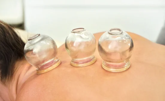 Cupping therapy cost