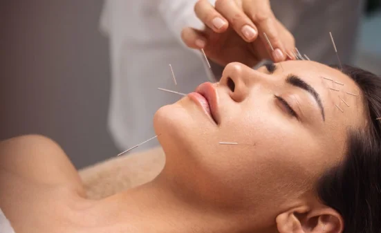 Neuro-Acupuncture in NY