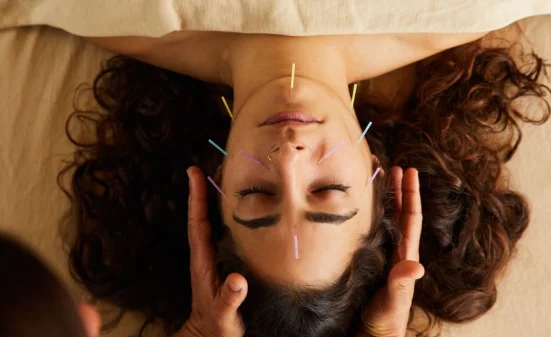 Cosmetic Acupuncture in Brooklyn