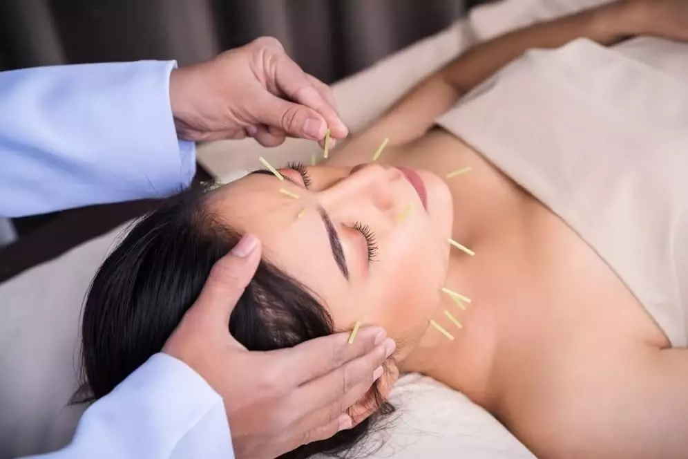 What is Facial Rejuvenation Acupuncture