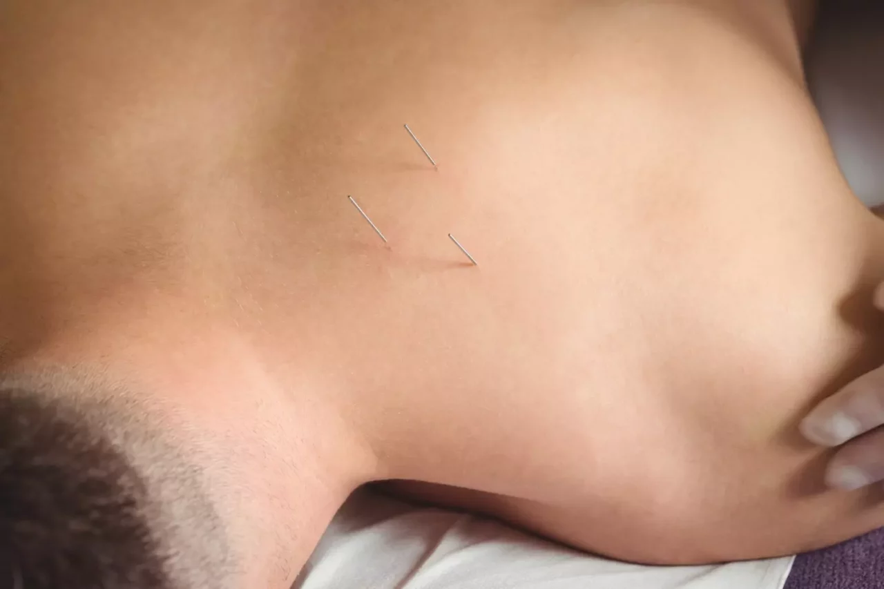 Benefits of Acupuncturedoes acupuncture help with anxiety