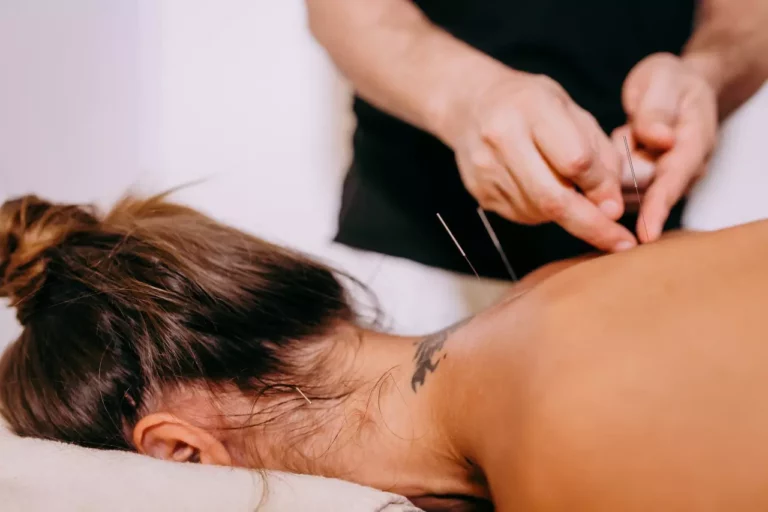 Can Acupuncture Help With Anxiety?