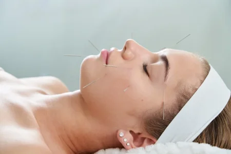 Cosmetic Acupuncture​ therapy