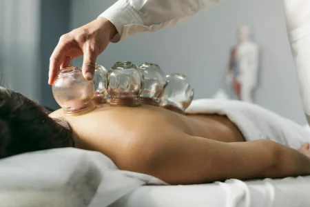 Cupping ​therapy