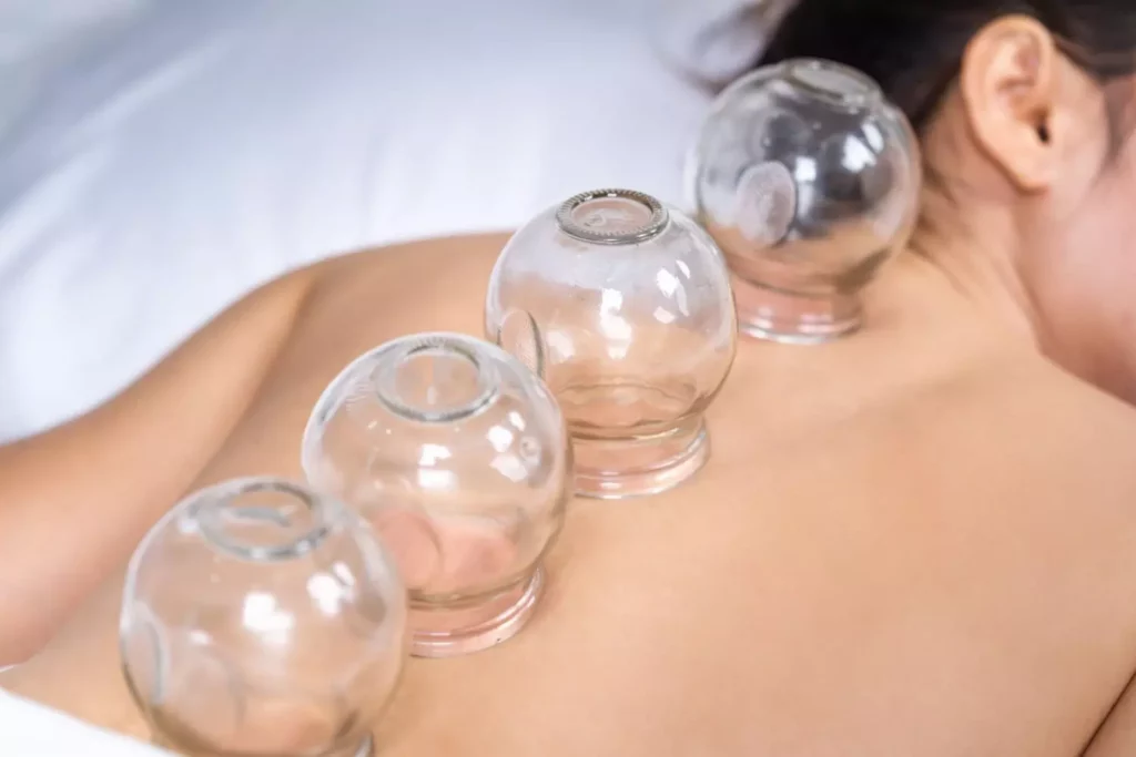 before and after cupping therapy