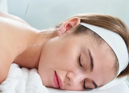Acupuncture for chronic headaches
