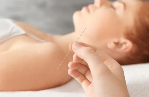 acupuncture for allergies and sinus