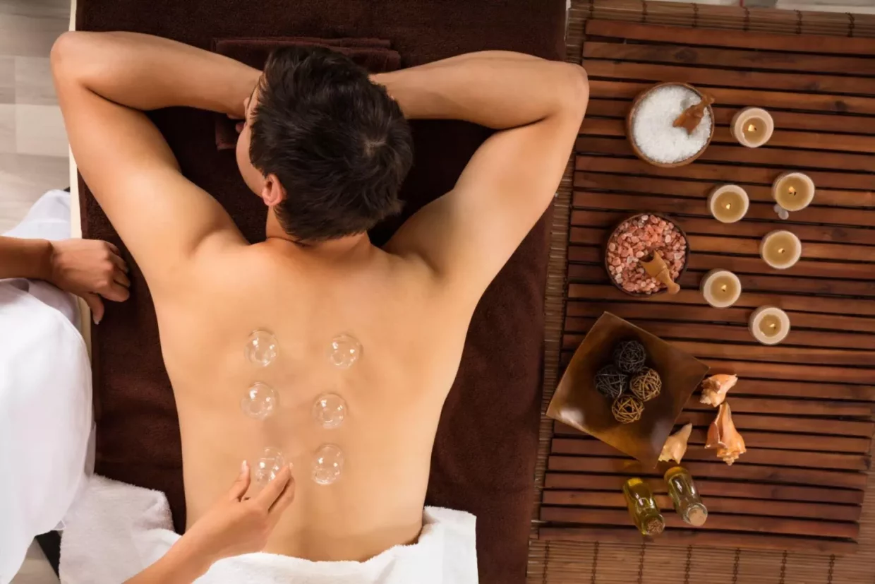 What does cupping do for your back