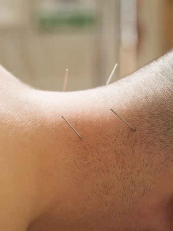 AcuNova Acupuncture in New Jersey