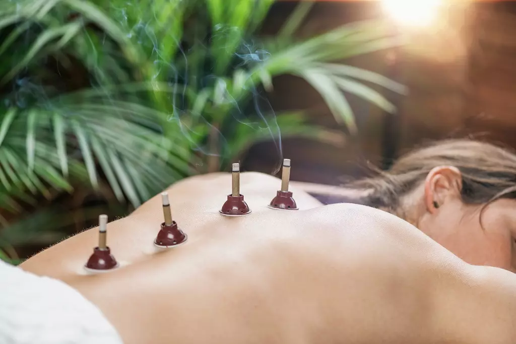 Moxibustion therapy in Clifton