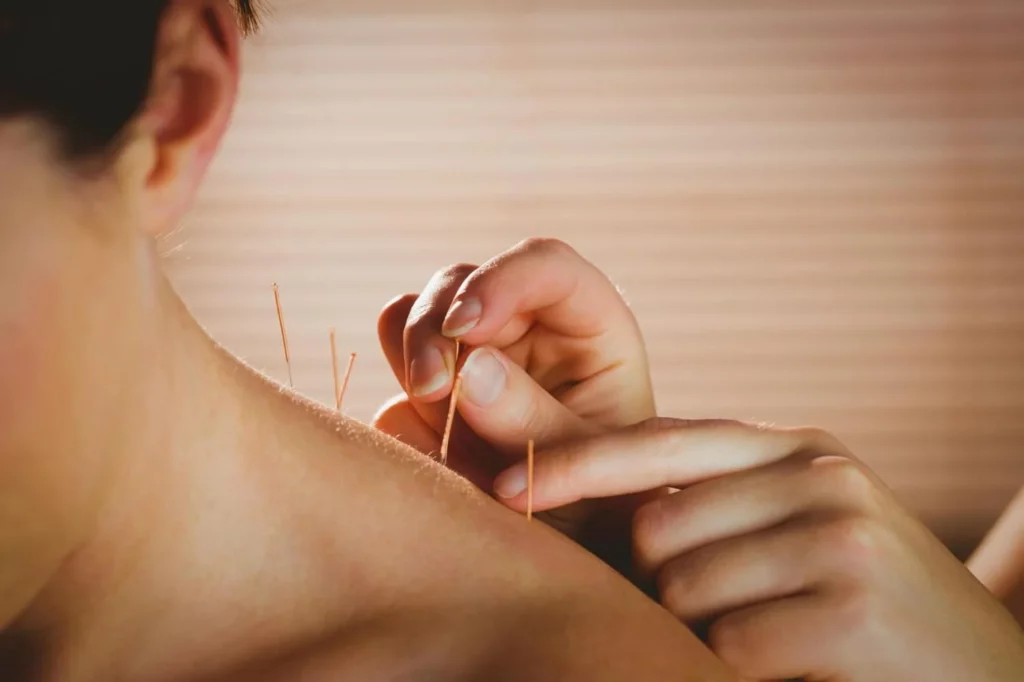 best acupuncture for neck pain