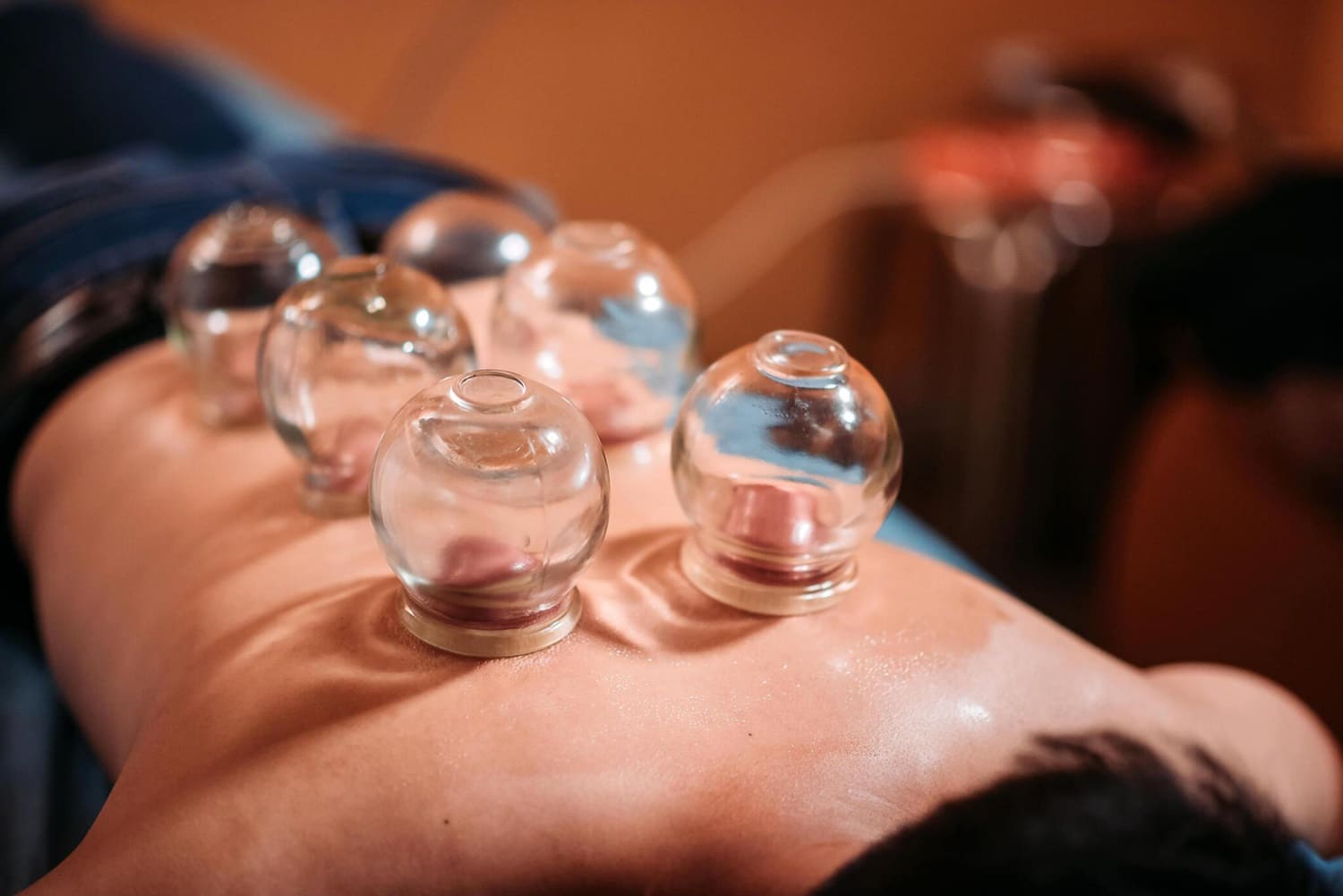 benefits of cupping therapy