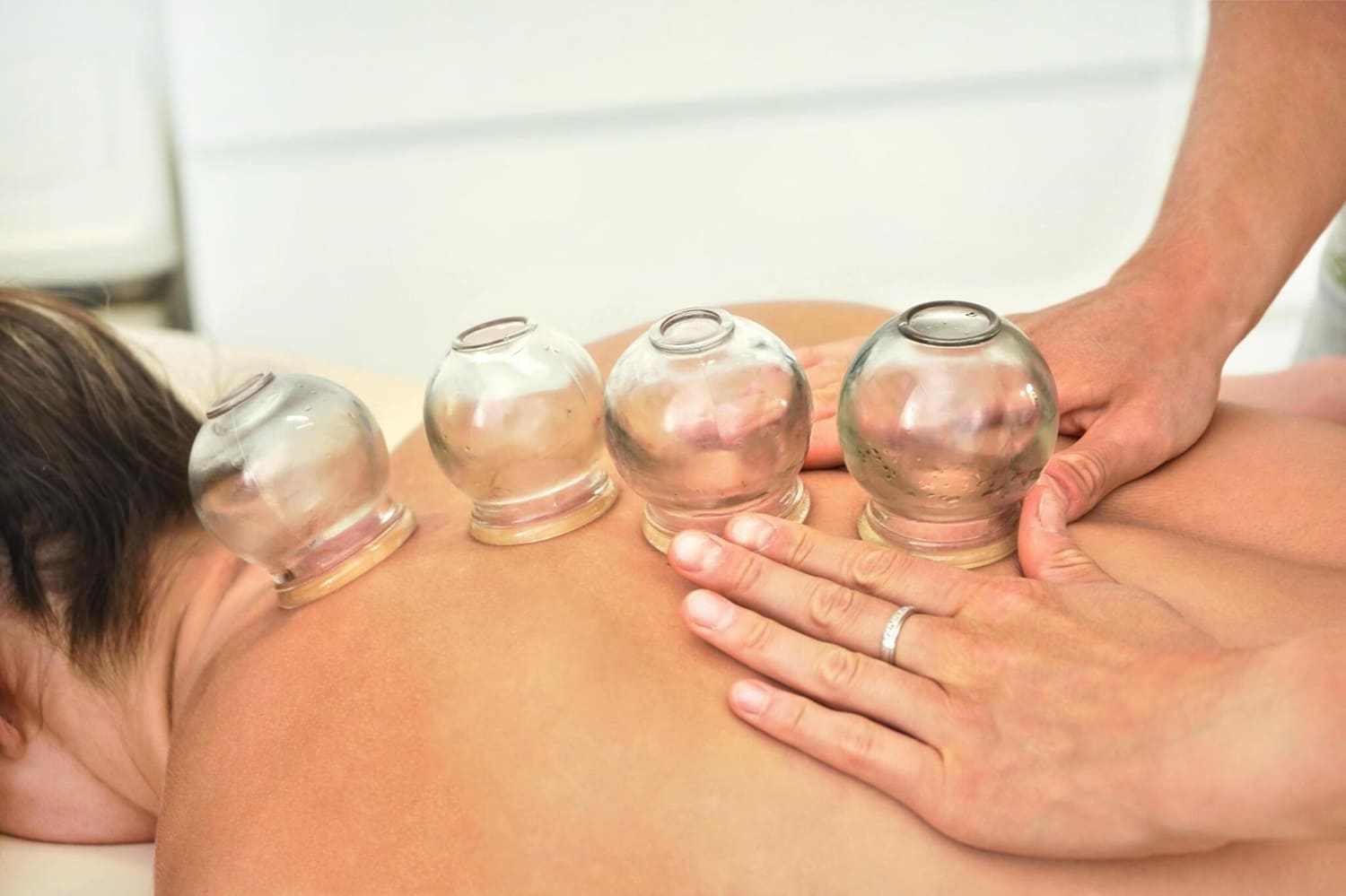 cupping therapy benefits