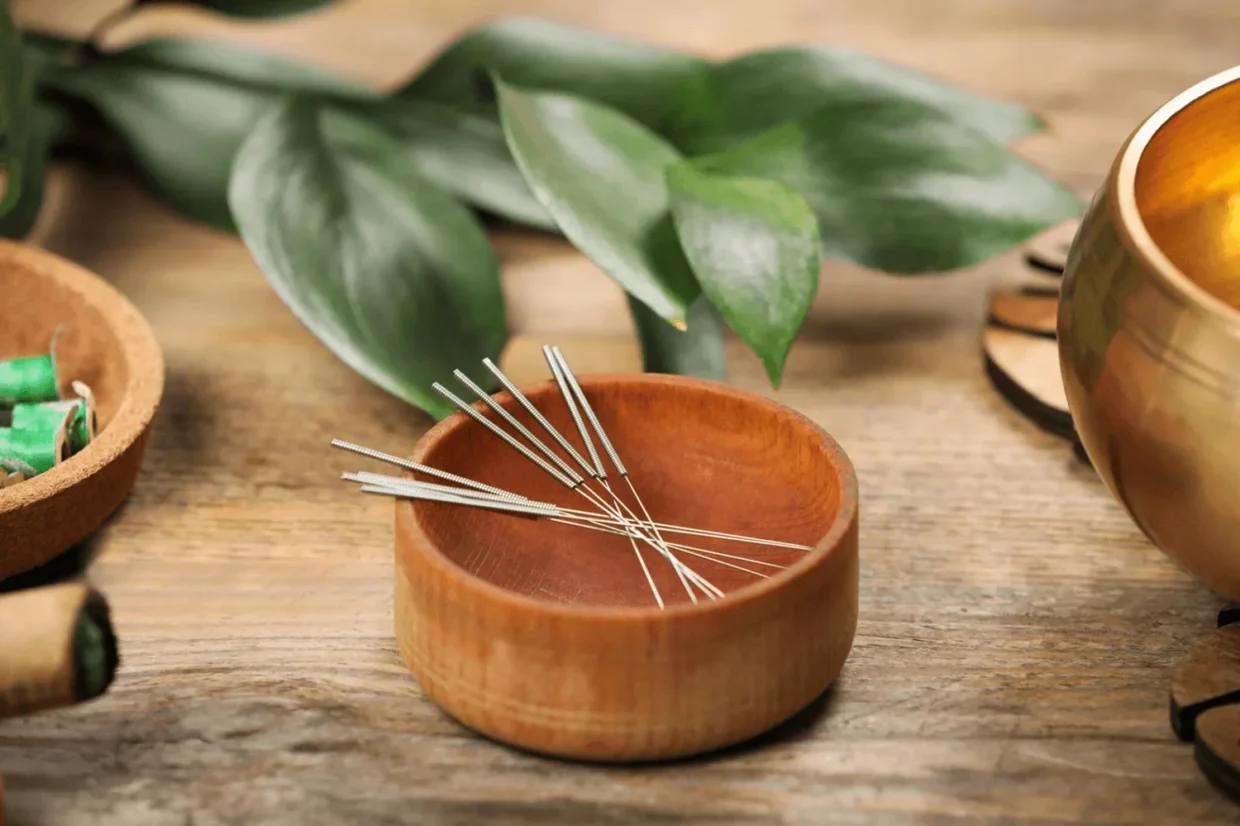 Acupuncture What You Need To Know