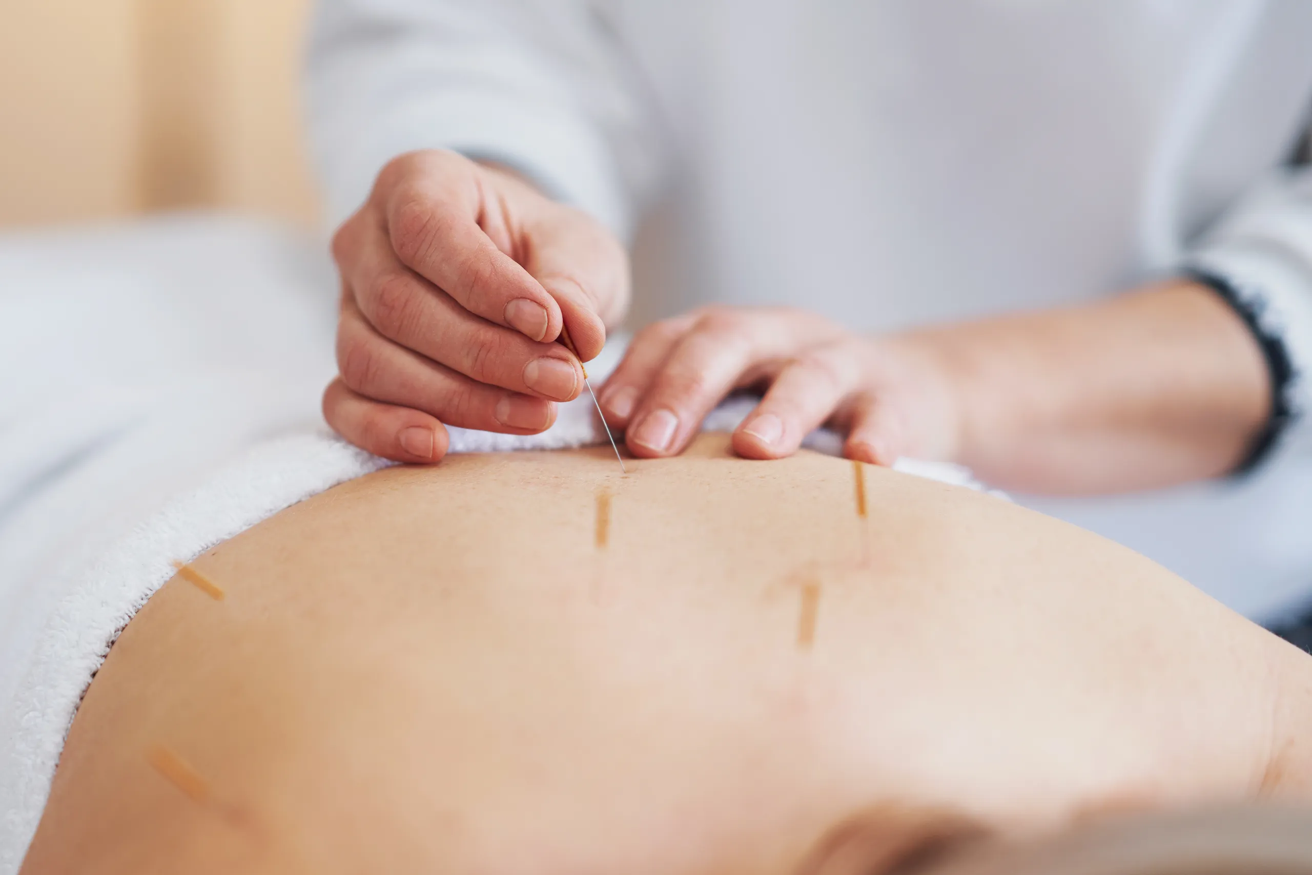 fatigue after acupuncture