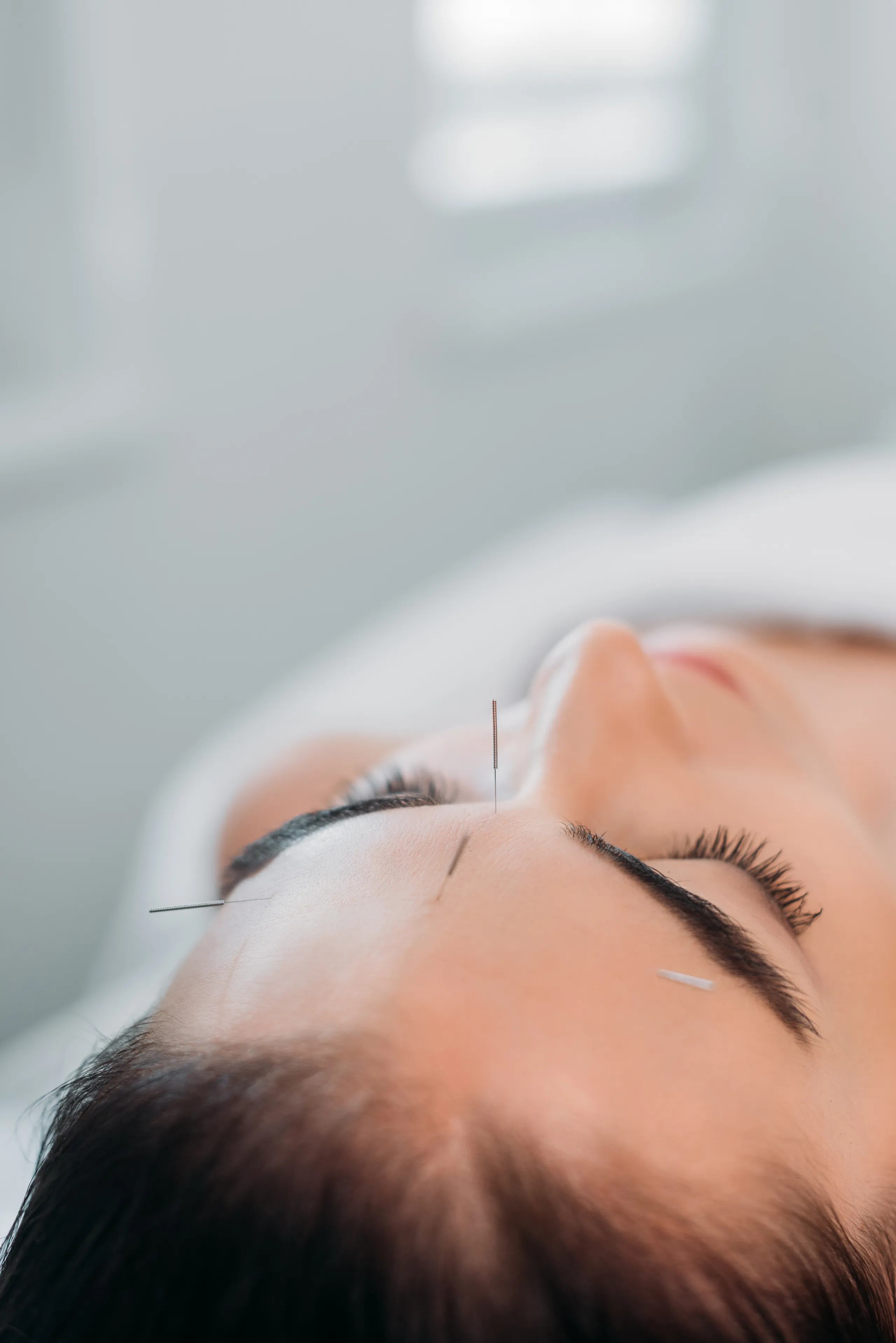 can acupuncture help with asthma