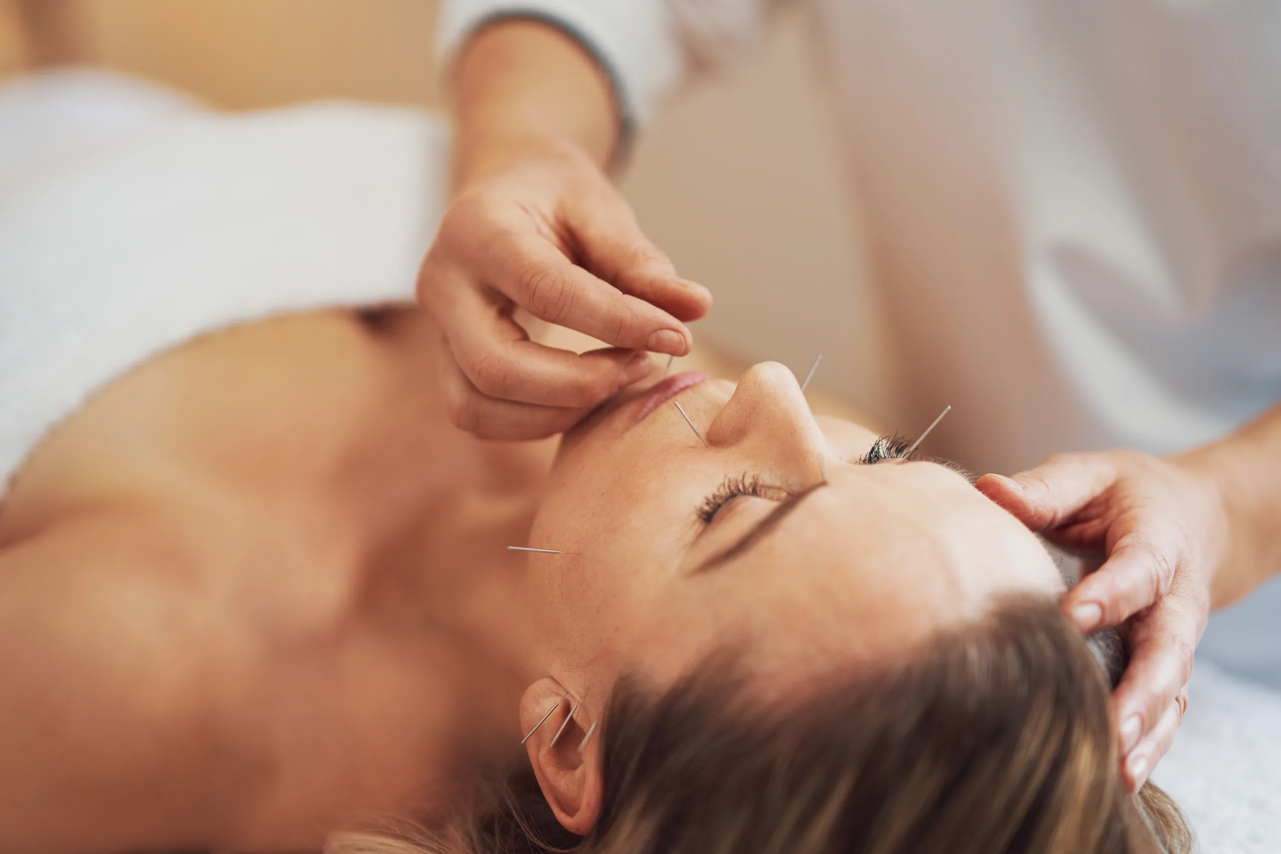 acupuncture points for anxiety